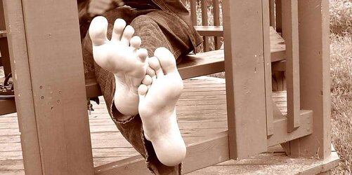 Fragile feet soles