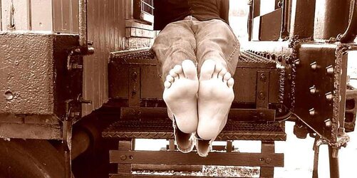 Fragile feet soles