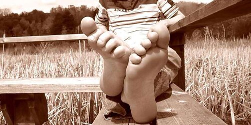 Fragile feet soles