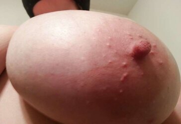 36 G boobies hoe Lateshay