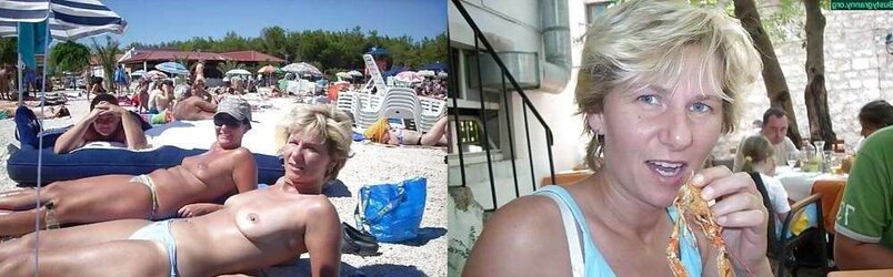 Before After 160.