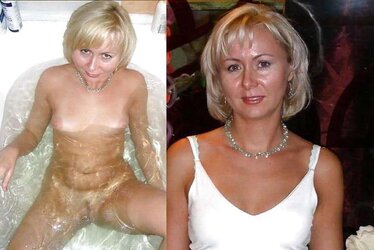 Before After 160.
