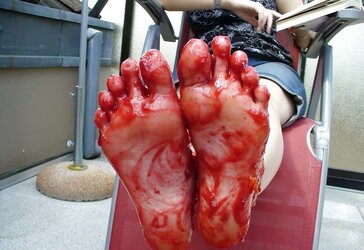 Barefeet and wedge