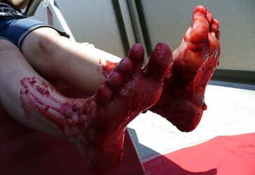Barefeet and wedge