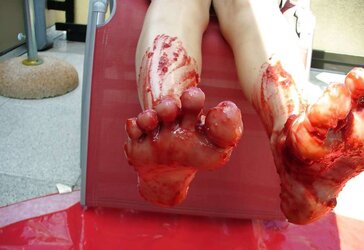 Barefeet and wedge