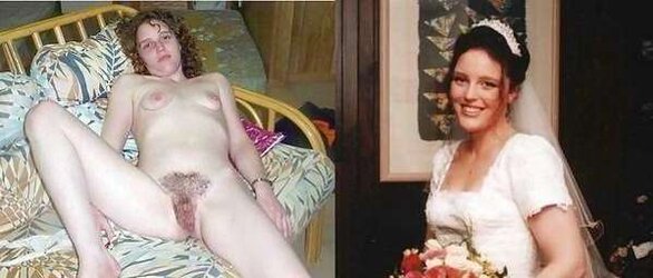 Before After 150.