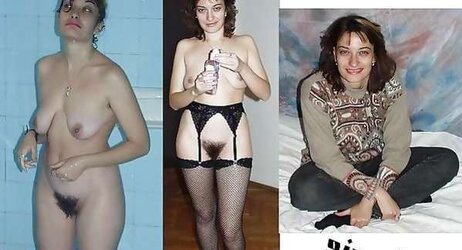 Before After 150.