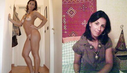 Before After 77.