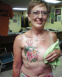 Amputee Mastectomy Handicapped