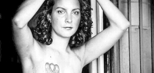 Amputee Mastectomy Handicapped