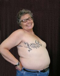 Amputee Mastectomy Handicapped