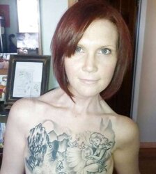 Amputee Mastectomy Handicapped