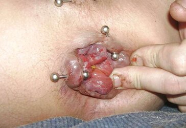 My juicy flower