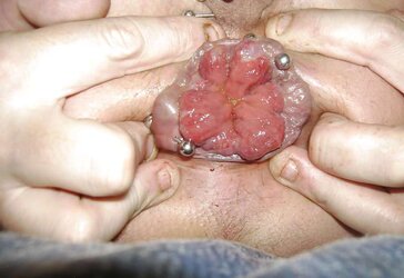 My juicy flower