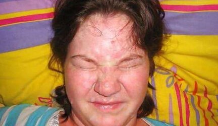 Chubby facials