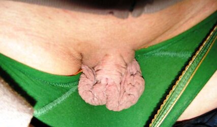 Large Puss Lips