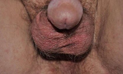 Tommiboi - Cuckold spouse