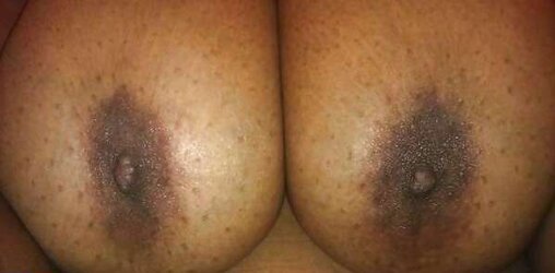 Massive super-sexy melons :)