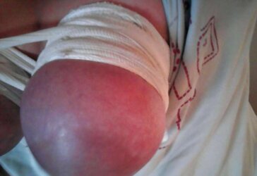 Schoen abgebundene Brueste