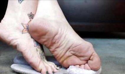 Puckered feet