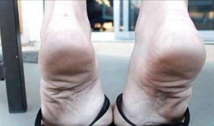 Puckered feet