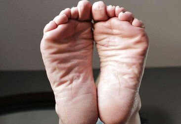 Puckered feet