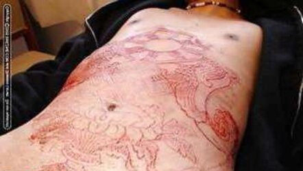 Teenagers and Scarification - Assets Modification