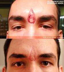 Teenagers and Scarification - Assets Modification