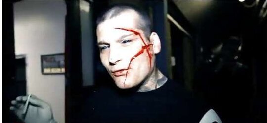 Teenagers and Scarification - Assets Modification