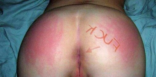 Oh roped again
