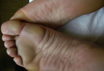 Donk,phat ass white girl,soles,feet ,white ,PLUMPER