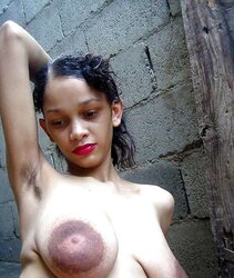 FAT Areola Latin