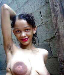 FAT Areola Latin