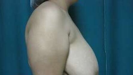 Fat congenital fledgling fun bags