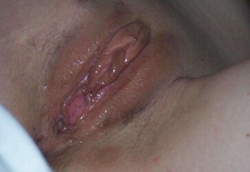 Teenagers with giant twat lips gigantic vulva large cunt or massive nub