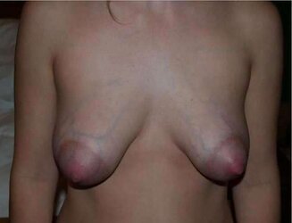 The Sweetheart of Teenager MUMMY Cougar Plumbed Up Boobs