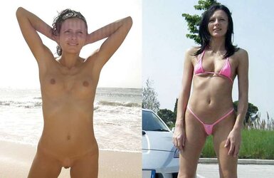 Before and After