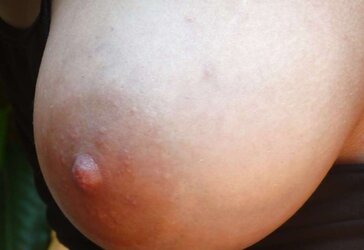 Ginormous areola of the boobies