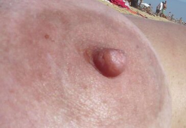 Ginormous areola of the boobies