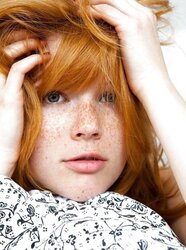 The Sweetheart of Congenital Redhead Teenager
