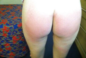 Various Photos of her smacked backside
