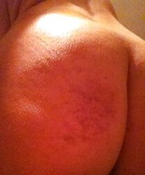 Various Photos of her smacked backside