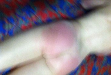 Various Photos of her smacked backside