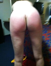 Various Photos of her smacked backside