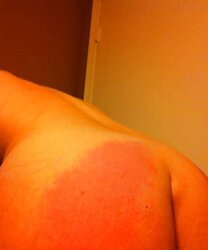 Various Photos of her smacked backside