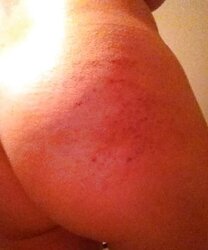 Various Photos of her smacked backside