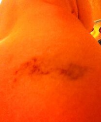 Various Photos of her smacked backside