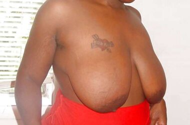 Ample dark-hued areolas ----yam-sized bevy---- part