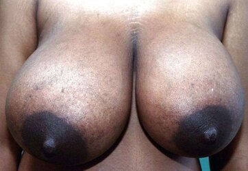 Ample dark-hued areolas ----yam-sized bevy---- part