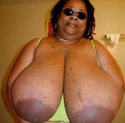 Ample dark-hued areolas ----yam-sized bevy---- part